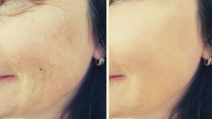 kolagen skóra zdrowie zmarszczki kosmetyki