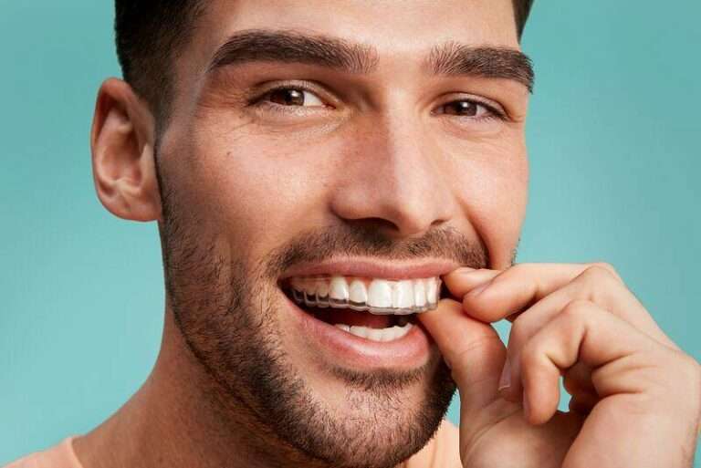 Czy noszenie aparatu ortodontycznego ogranicza jadłospis?